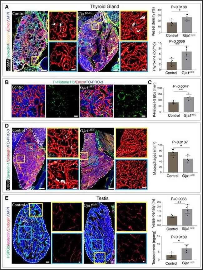 Rabbit IgG (H+L) Highly Cross-Adsorbed Secondary Antibody in Immunohistochemistry (Paraffin) (IHC (P))