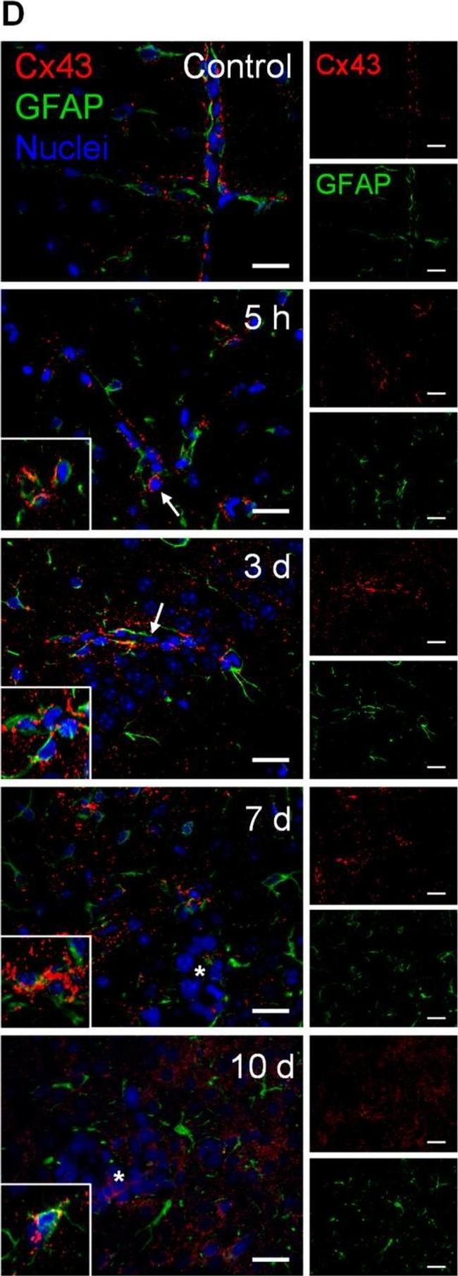 Mouse IgG (H+L) Cross-Adsorbed Secondary Antibody in Immunocytochemistry (ICC/IF)