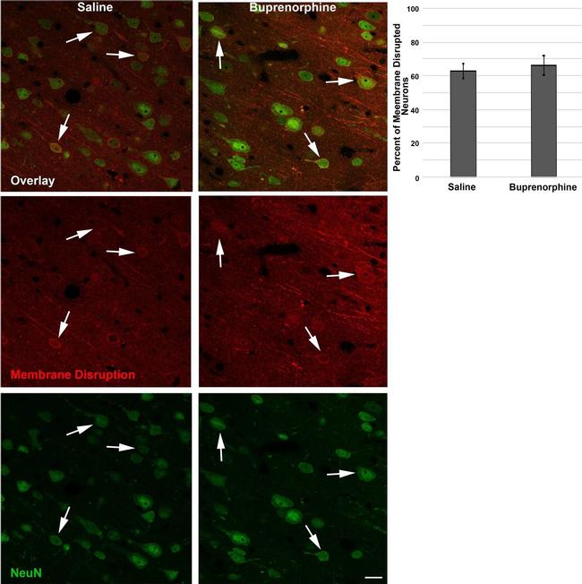 Goat IgG (H+L) Cross-Adsorbed Secondary Antibody in Immunohistochemistry (IHC)