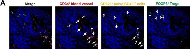 Mouse IgG (H+L) Cross-Adsorbed Secondary Antibody in Immunohistochemistry (IHC)