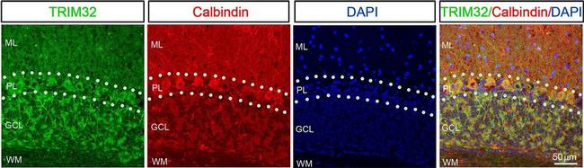 Mouse IgG (H+L) Highly Cross-Adsorbed Secondary Antibody in Immunohistochemistry (IHC)