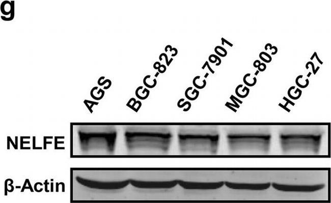 Rabbit IgG (H+L) Secondary Antibody in Western Blot (WB)