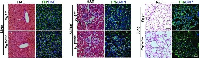 Rabbit IgG (H+L) Cross-Adsorbed Secondary Antibody in Immunohistochemistry (IHC)