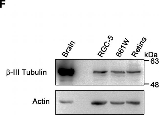 Rat IgG (H+L) Secondary Antibody in Western Blot (WB)