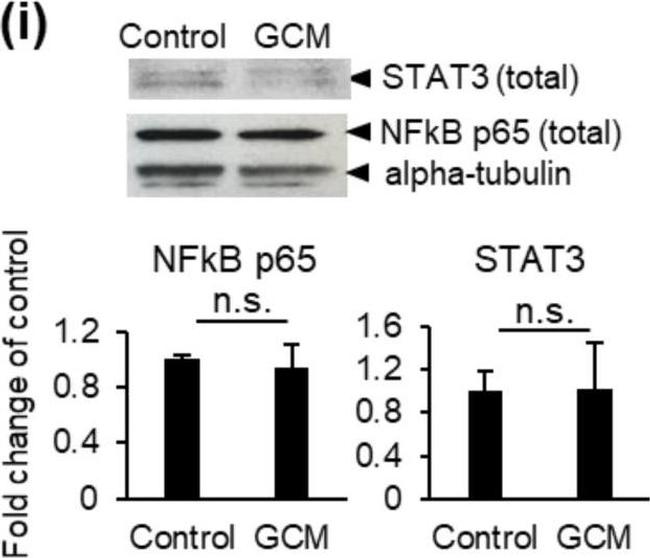 Rat IgG (H+L) Secondary Antibody in Western Blot (WB)