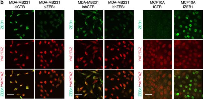 Mouse IgG (H+L) Cross-Adsorbed Secondary Antibody in Immunocytochemistry (ICC/IF)