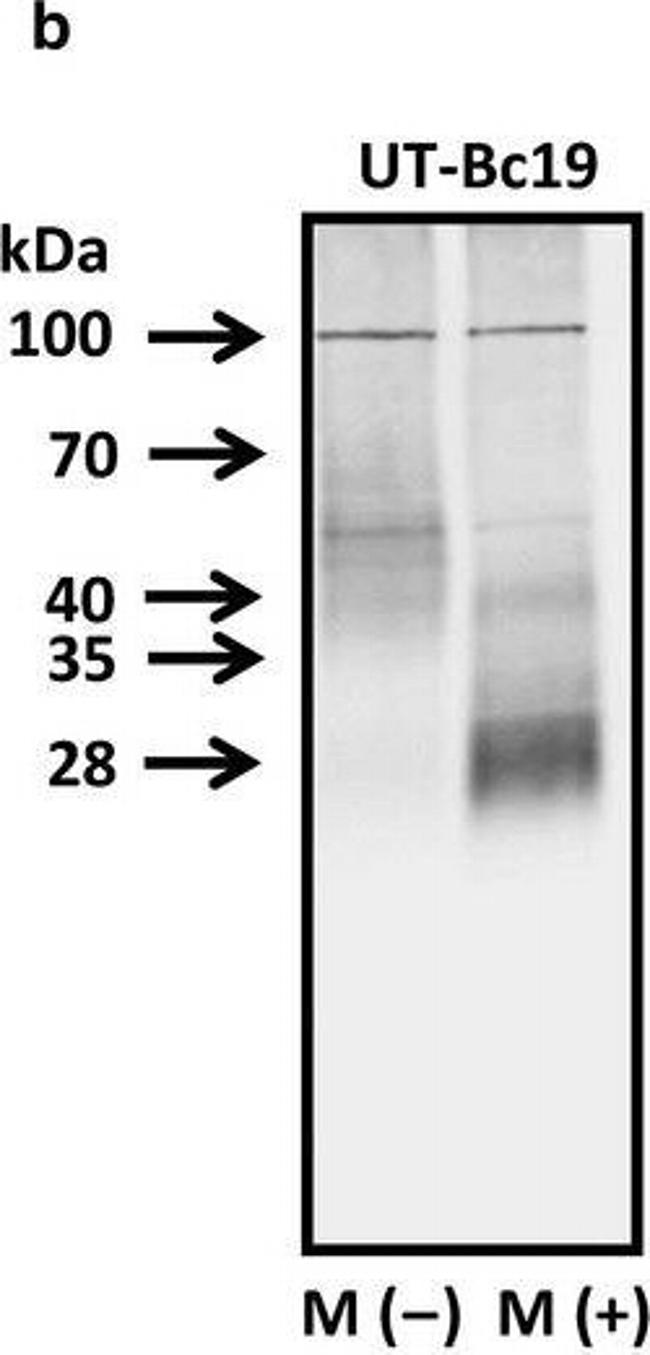 Mouse IgG (H+L) Secondary Antibody in Western Blot (WB)