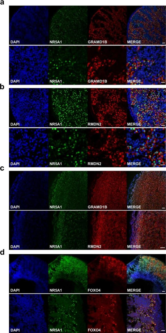 Rabbit IgG (H+L) Highly Cross-Adsorbed Secondary Antibody in Immunohistochemistry (IHC)