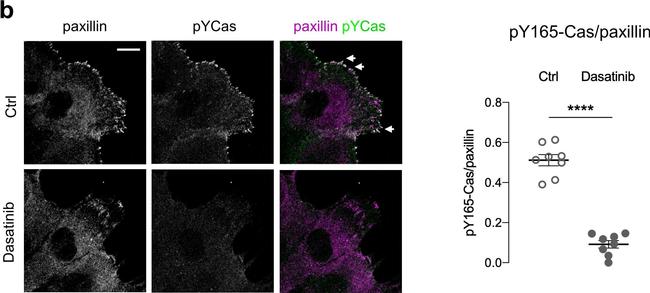 Rabbit IgG (H+L) Cross-Adsorbed Secondary Antibody in Immunocytochemistry (ICC/IF)