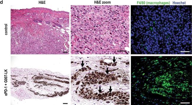 Rat IgG (H+L) Highly Cross-Adsorbed Secondary Antibody in Immunohistochemistry (IHC)