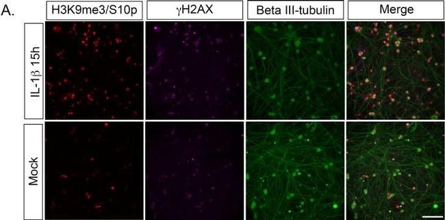 Mouse IgG (H+L) Cross-Adsorbed Secondary Antibody in Immunocytochemistry (ICC/IF)