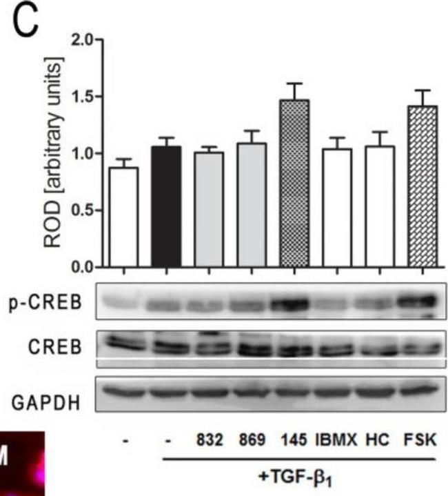 Rabbit IgG (H+L) Secondary Antibody in Western Blot (WB)