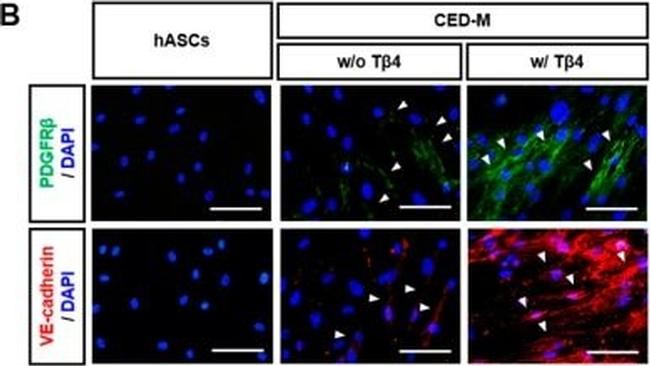 Mouse IgG (H+L) Cross-Adsorbed Secondary Antibody in Immunocytochemistry (ICC/IF)