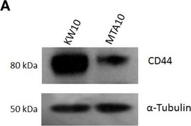 Mouse IgG (H+L) Secondary Antibody in Western Blot (WB)