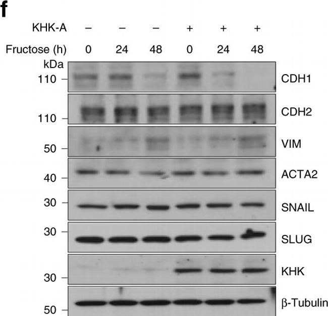 Rabbit IgG (H+L) Cross-Adsorbed Secondary Antibody in Western Blot (WB)