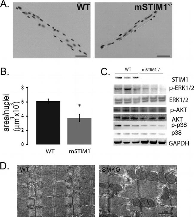 STIM1 Antibody in Western Blot (WB)