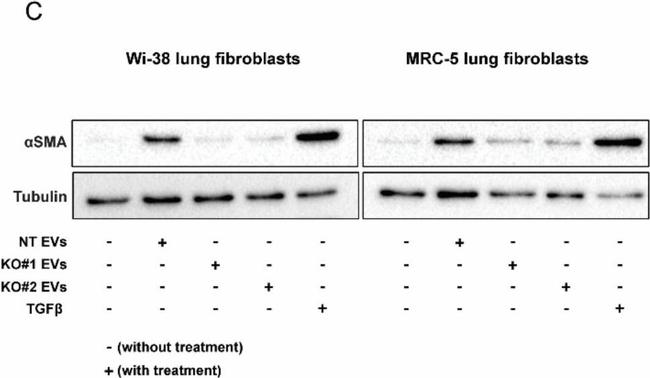 Mouse IgG, IgM, IgA (H+L) Secondary Antibody in Western Blot (WB)