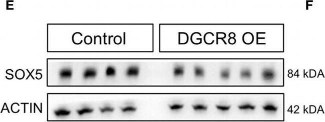 Rabbit IgG (H+L) Cross-Adsorbed Secondary Antibody in Western Blot (WB)