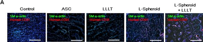 Rabbit IgG (H+L) Cross-Adsorbed Secondary Antibody in Immunocytochemistry (ICC/IF)