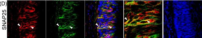 Mouse IgG (H+L) Cross-Adsorbed Secondary Antibody in Immunohistochemistry (IHC)