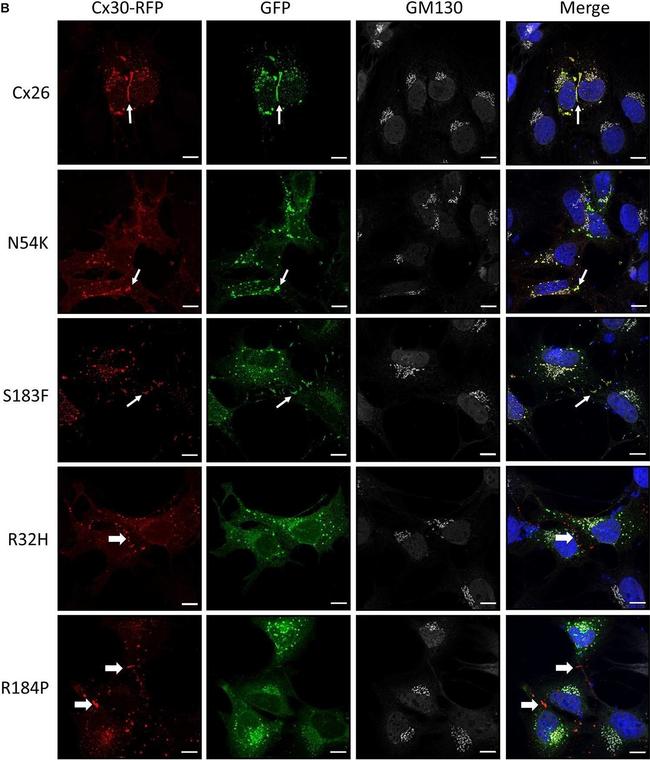 Rabbit IgG (H+L) Highly Cross-Adsorbed Secondary Antibody in Immunocytochemistry (ICC/IF)