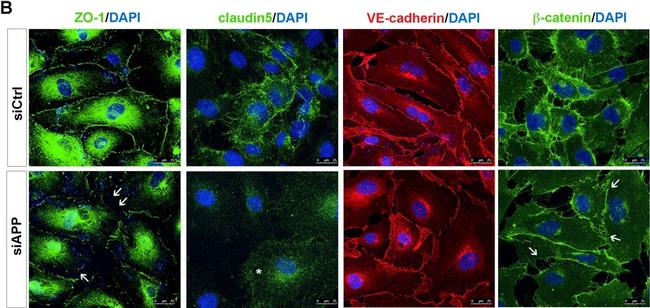 Mouse IgG (H+L) Highly Cross-Adsorbed Secondary Antibody in Immunocytochemistry (ICC/IF)