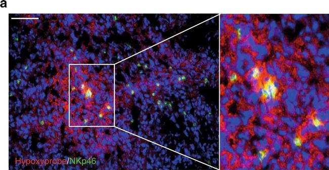 Rat IgG (H+L) Cross-Adsorbed Secondary Antibody in Immunohistochemistry (Paraffin) (IHC (P))