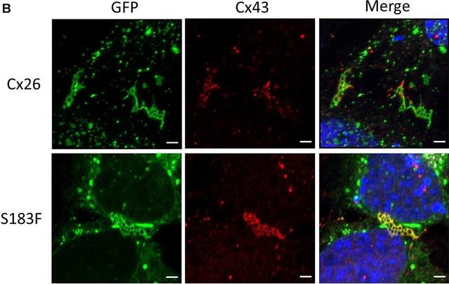 Rabbit IgG (H+L) Highly Cross-Adsorbed Secondary Antibody in Immunocytochemistry (ICC/IF)