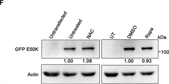 Rat IgG (H+L) Secondary Antibody in Western Blot (WB)