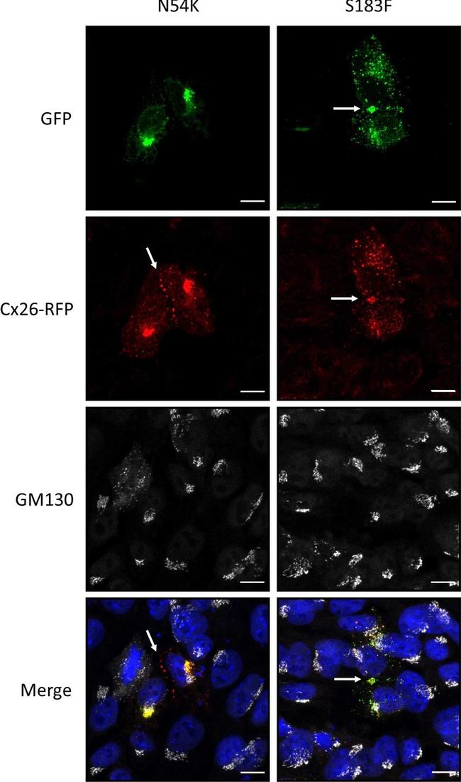 Rabbit IgG (H+L) Highly Cross-Adsorbed Secondary Antibody in Immunocytochemistry (ICC/IF)