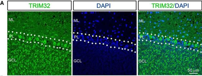 Mouse IgG (H+L) Highly Cross-Adsorbed Secondary Antibody in Immunohistochemistry (IHC)