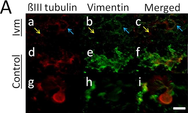 Mouse IgG (H+L) Cross-Adsorbed Secondary Antibody in Immunocytochemistry (ICC/IF)