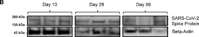 Human IgG1 Fc Secondary Antibody in Western Blot (WB)