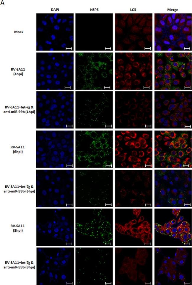 Rabbit IgG (H+L) Secondary Antibody in Immunocytochemistry (ICC/IF)