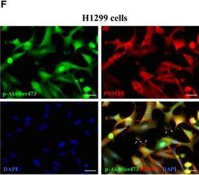 Mouse IgG (H+L) Cross-Adsorbed Secondary Antibody in Immunocytochemistry (ICC/IF)