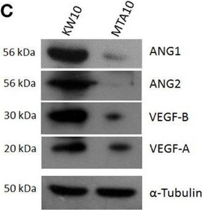 Mouse IgG (H+L) Secondary Antibody in Western Blot (WB)