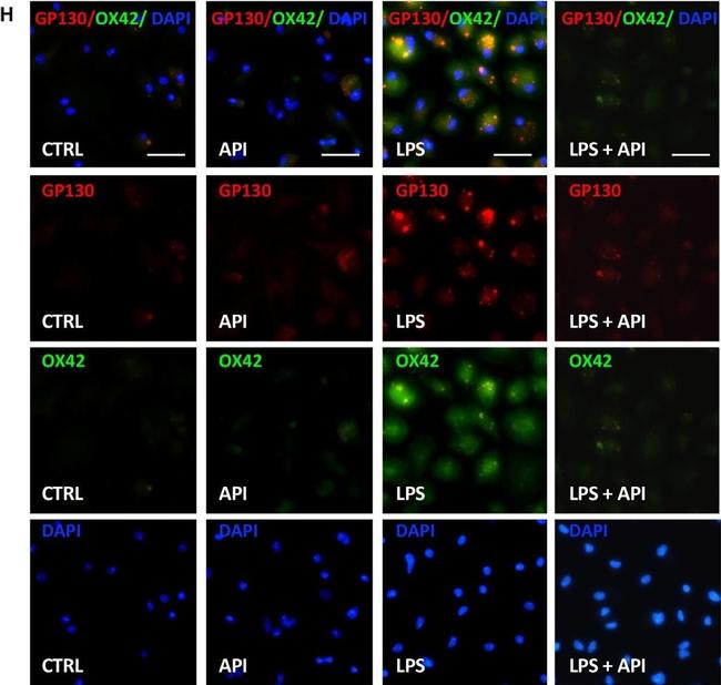 Rabbit IgG (H+L) Cross-Adsorbed Secondary Antibody in Immunocytochemistry (ICC/IF)