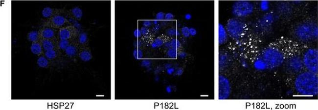 Mouse IgG (H+L) Cross-Adsorbed Secondary Antibody in Immunocytochemistry (ICC/IF)