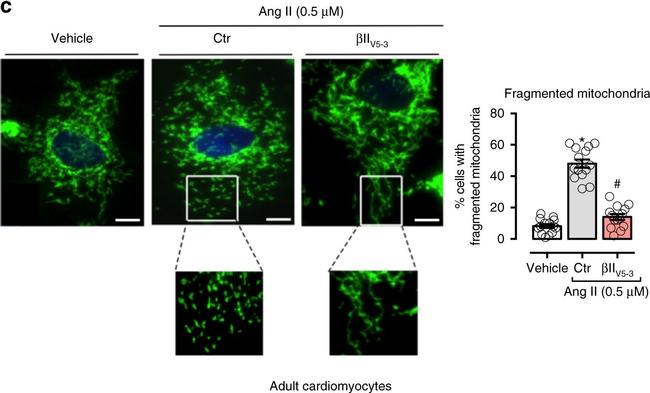 Rabbit IgG (H+L) Secondary Antibody in Immunocytochemistry (ICC/IF)