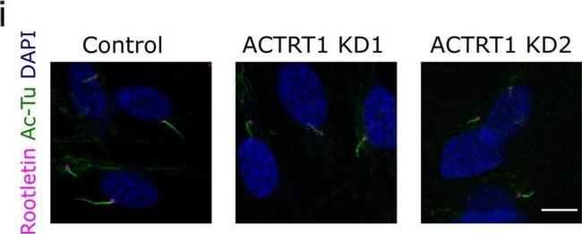 Mouse IgG (H+L) Cross-Adsorbed Secondary Antibody in Immunocytochemistry (ICC/IF)