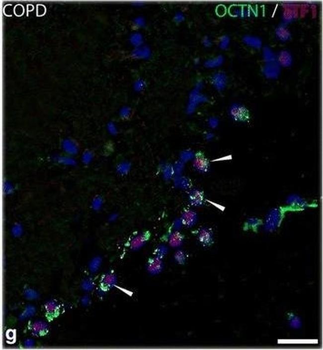 Mouse IgG (H+L) Cross-Adsorbed Secondary Antibody in Immunohistochemistry (IHC)