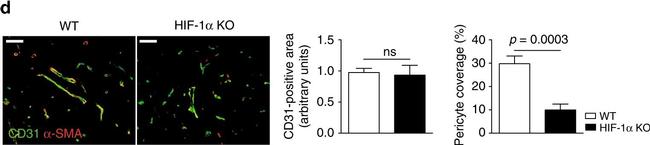 Rat IgG (H+L) Cross-Adsorbed Secondary Antibody in Immunohistochemistry (Paraffin) (IHC (P))