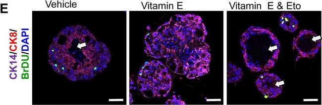 Mouse IgG (H+L) Cross-Adsorbed Secondary Antibody in Immunohistochemistry (IHC)