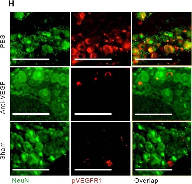 Mouse IgG (H+L) Highly Cross-Adsorbed Secondary Antibody in Immunohistochemistry (Paraffin) (IHC (P))