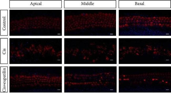 Rabbit IgG (H+L) Highly Cross-Adsorbed Secondary Antibody in Immunohistochemistry (PFA fixed) (IHC (PFA))