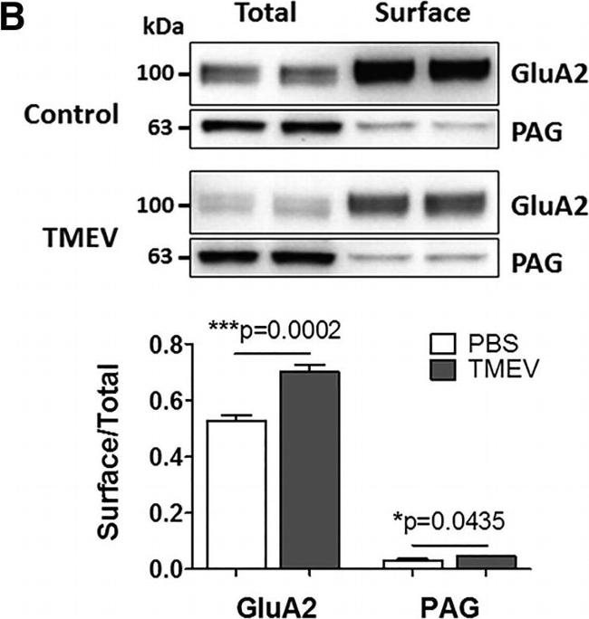 Rabbit IgG (H+L) Secondary Antibody in Western Blot (WB)