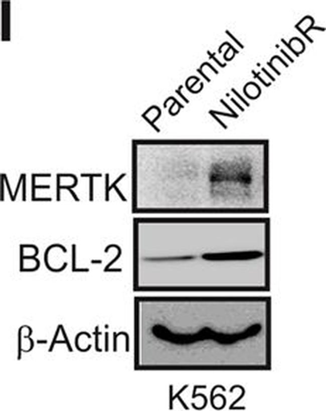 Goat IgG (H+L) Secondary Antibody in Western Blot (WB)