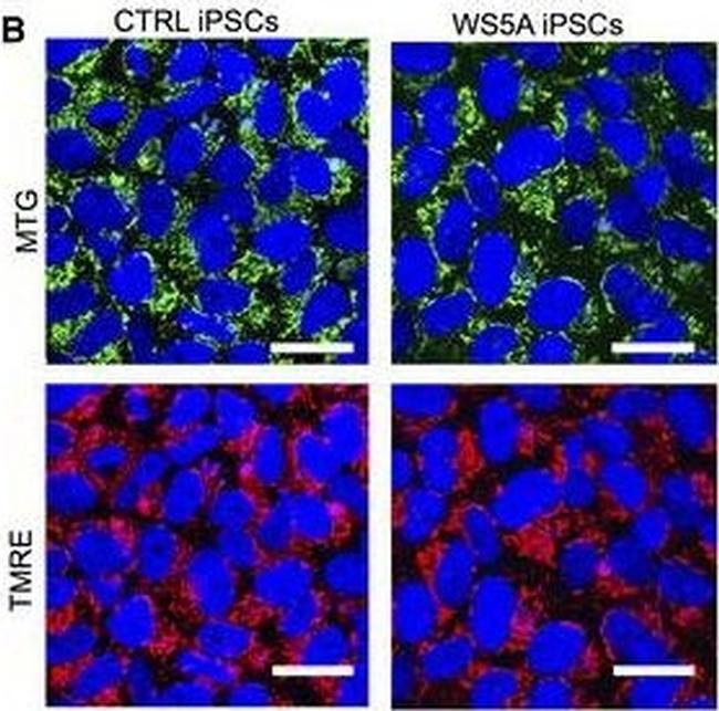 Mouse IgG (H+L) Cross-Adsorbed Secondary Antibody in Immunocytochemistry (ICC/IF)