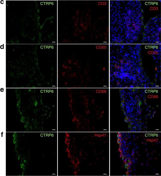 Mouse IgG (H+L) Highly Cross-Adsorbed Secondary Antibody in Immunohistochemistry (IHC)