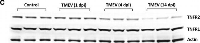 Rabbit IgG (H+L) Secondary Antibody in Western Blot (WB)